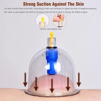 Kit de Ventouses Professionnelles (32 Pièces) – Thérapie par Vide & Anti-Cellulite